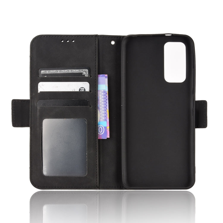 For Xiaomi Redmi Note 11S / Note 11 4G Overseas Version Skin Feel Calf Pattern Leather Phone Case