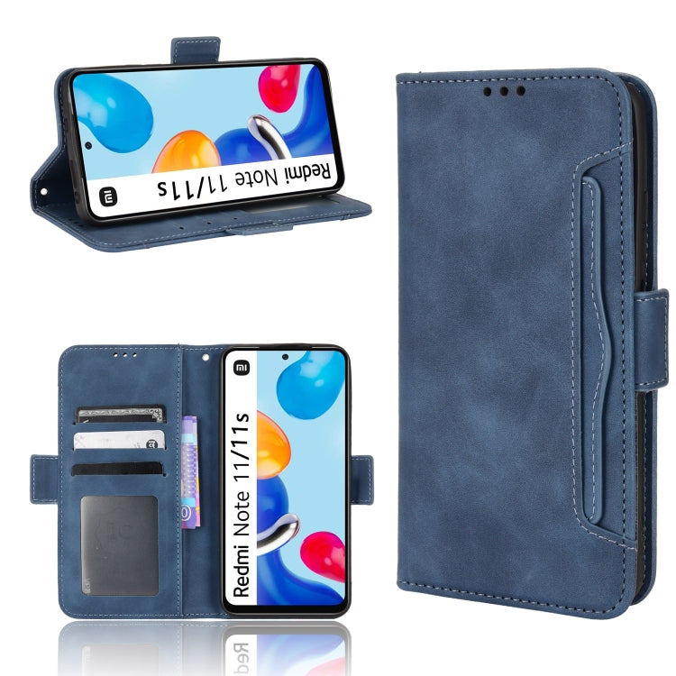 For Xiaomi Redmi Note 11S / Note 11 4G Overseas Version Skin Feel Calf Pattern Leather Phone Case