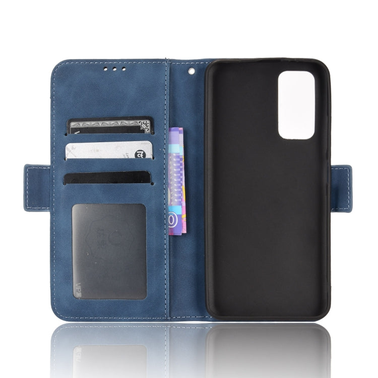 For Xiaomi Redmi Note 11S / Note 11 4G Overseas Version Skin Feel Calf Pattern Leather Phone Case