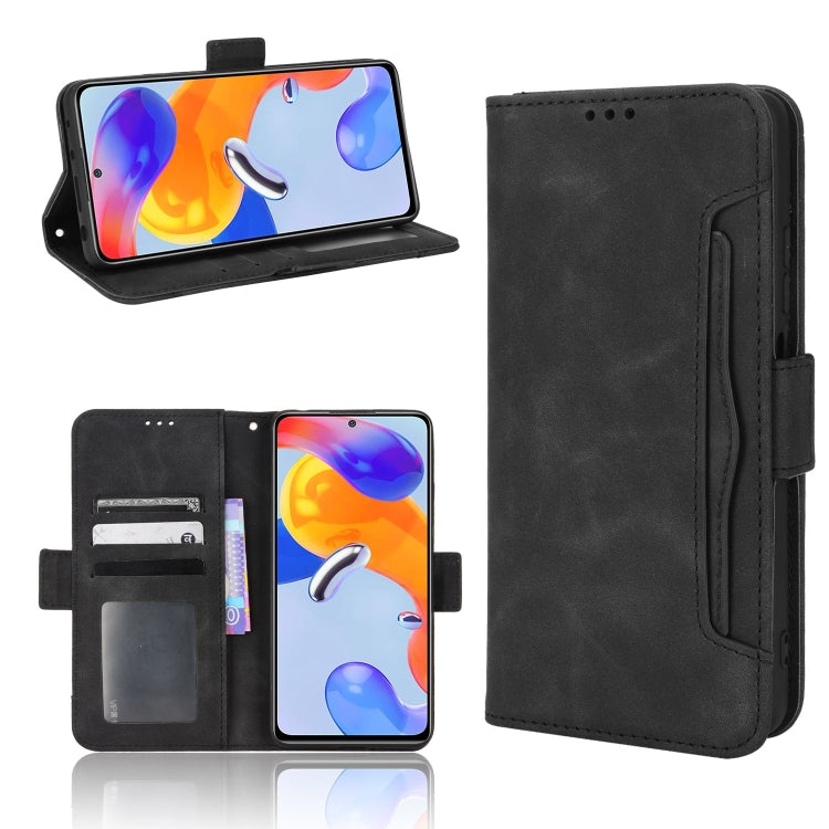 For Xiaomi Redmi Note 11 Pro 4G / 5G Overseas Version Skin Feel Calf Pattern Leather Phone Case