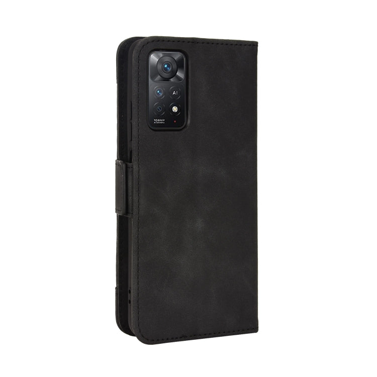 For Xiaomi Redmi Note 11 Pro 4G / 5G Overseas Version Skin Feel Calf Pattern Leather Phone Case
