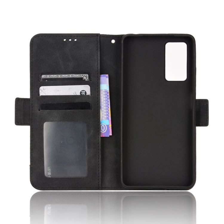 For Xiaomi Redmi Note 11 Pro 4G / 5G Overseas Version Skin Feel Calf Pattern Leather Phone Case
