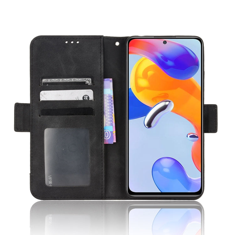 For Xiaomi Redmi Note 11 Pro 4G / 5G Overseas Version Skin Feel Calf Pattern Leather Phone Case
