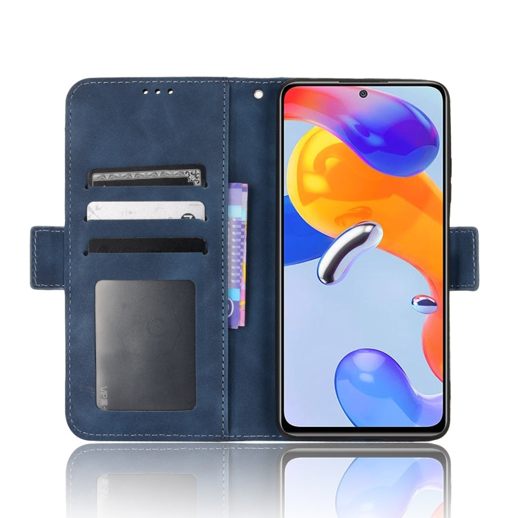 For Xiaomi Redmi Note 11 Pro 4G / 5G Overseas Version Skin Feel Calf Pattern Leather Phone Case