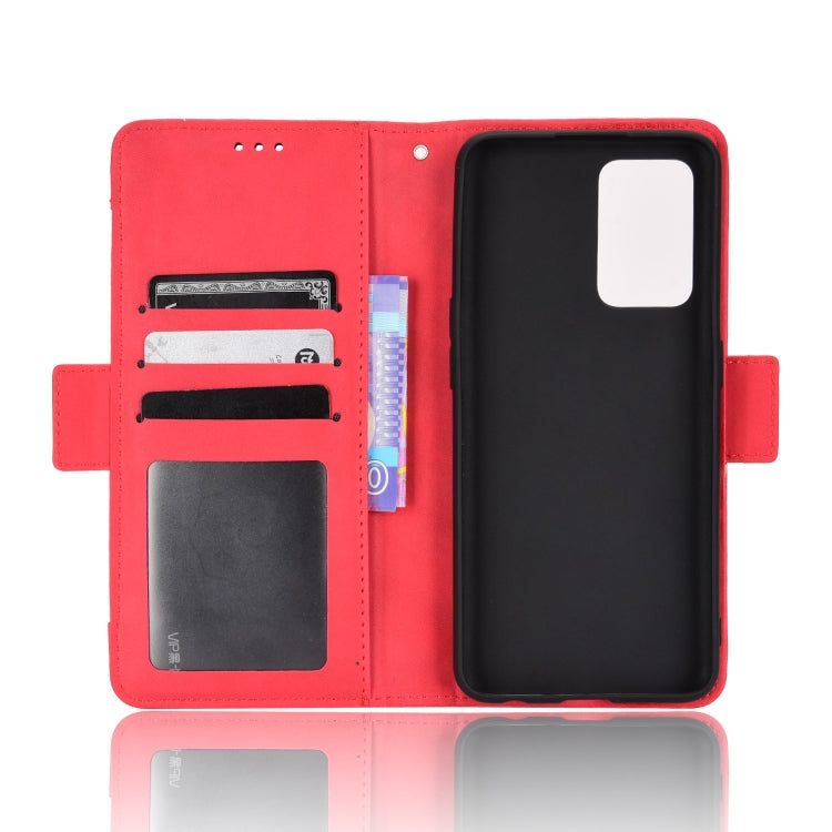 For OPPO Reno7 5G / Find X5 Lite Skin Feel Calf Pattern Leather Phone Case