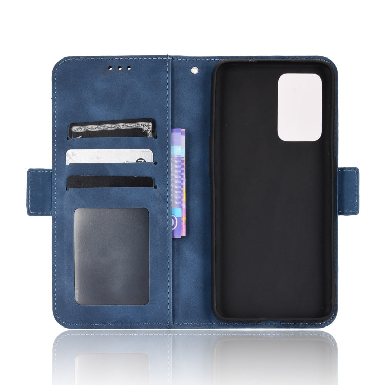 For OPPO Reno7 5G / Find X5 Lite Skin Feel Calf Pattern Leather Phone Case