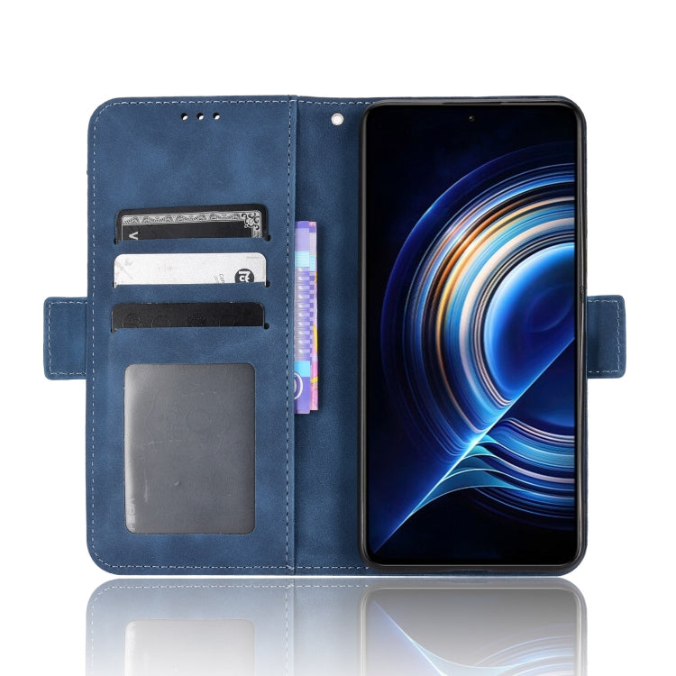 For Xiaomi Redmi K40S Skin Feel Calf Pattern Leather Phone Case