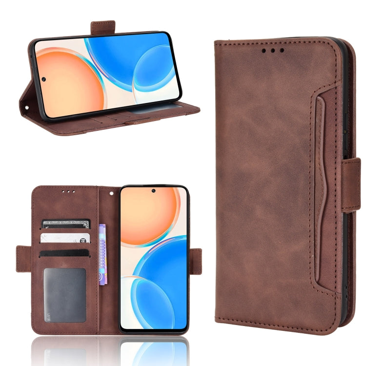 For Honor X8 Skin Feel Calf Pattern Leather Phone Case