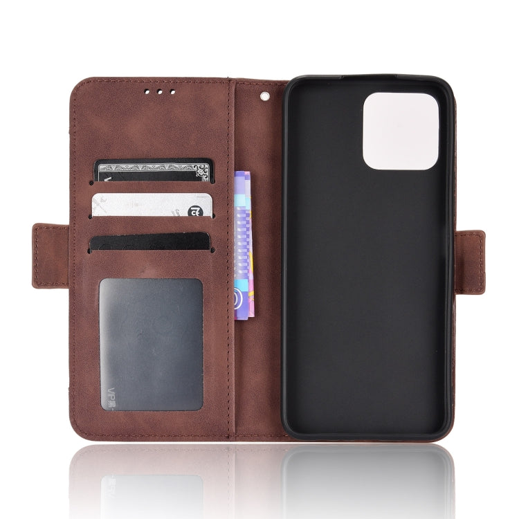For Honor X8 Skin Feel Calf Pattern Leather Phone Case