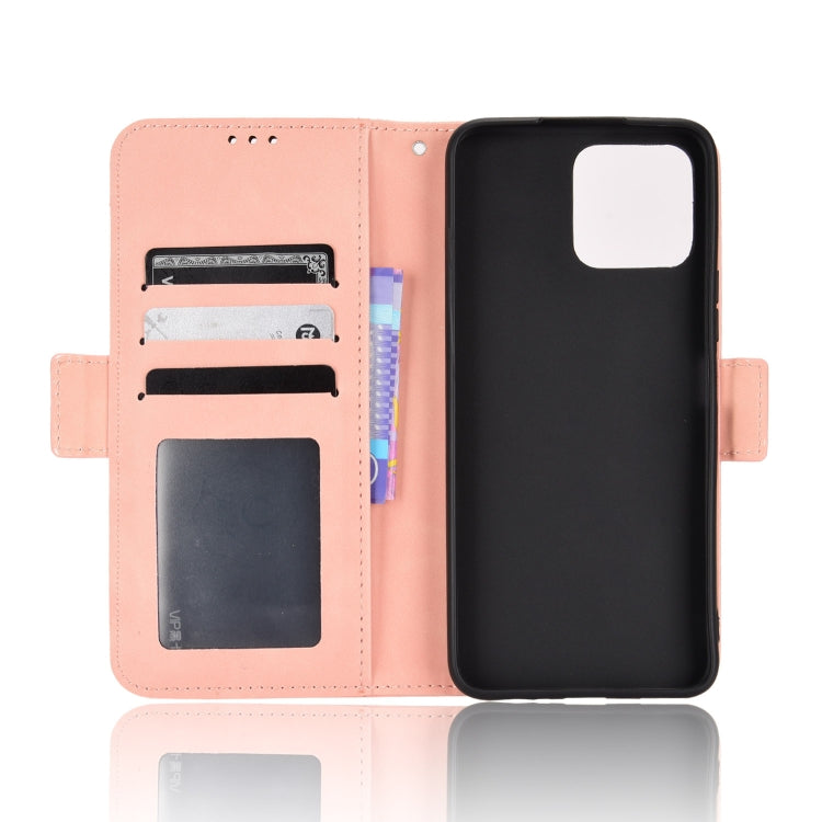 For Honor X8 Skin Feel Calf Pattern Leather Phone Case