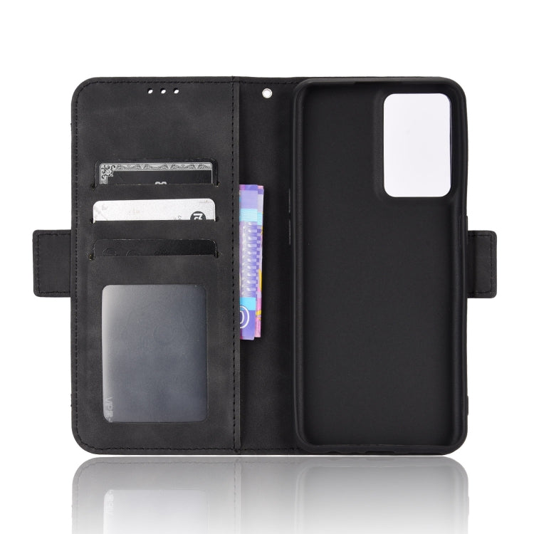 For OnePlus Nord CE 2 5G Skin Feel Calf Pattern Leather Phone Case