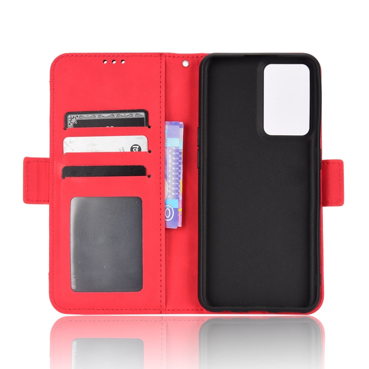 For OnePlus Nord CE 2 5G Skin Feel Calf Pattern Leather Phone Case