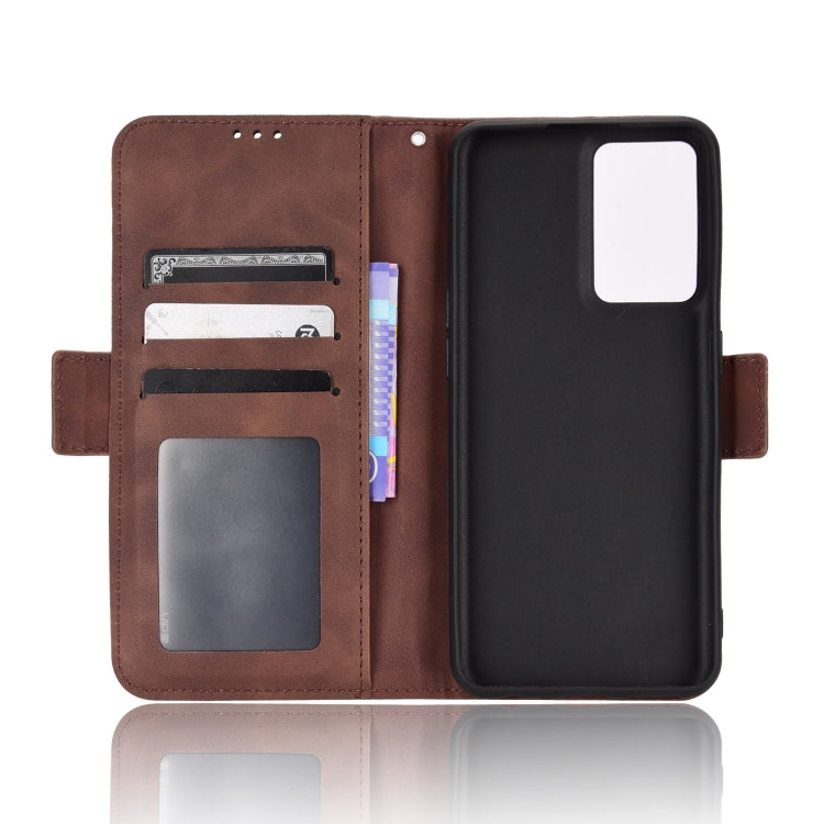 For OnePlus Nord CE 2 5G Skin Feel Calf Pattern Leather Phone Case