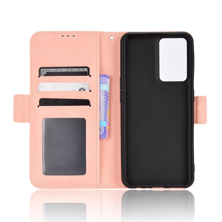 For OnePlus Nord CE 2 5G Skin Feel Calf Pattern Leather Phone Case