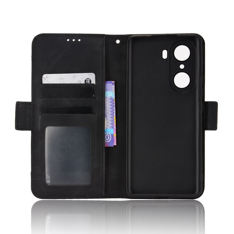 For Honor 60 Skin Feel Calf Pattern Leather Phone Case