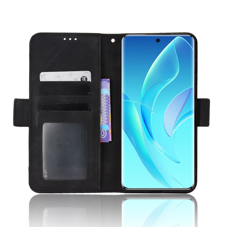 For Honor 60 Skin Feel Calf Pattern Leather Phone Case