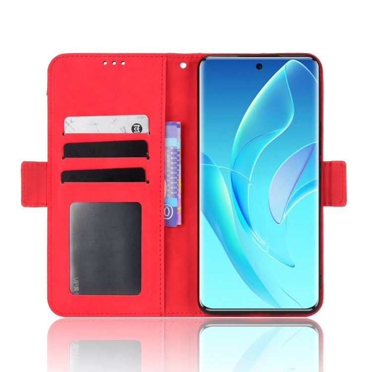 For Honor 60 Skin Feel Calf Pattern Leather Phone Case
