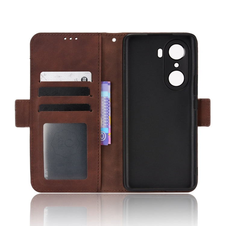 For Honor 60 Skin Feel Calf Pattern Leather Phone Case