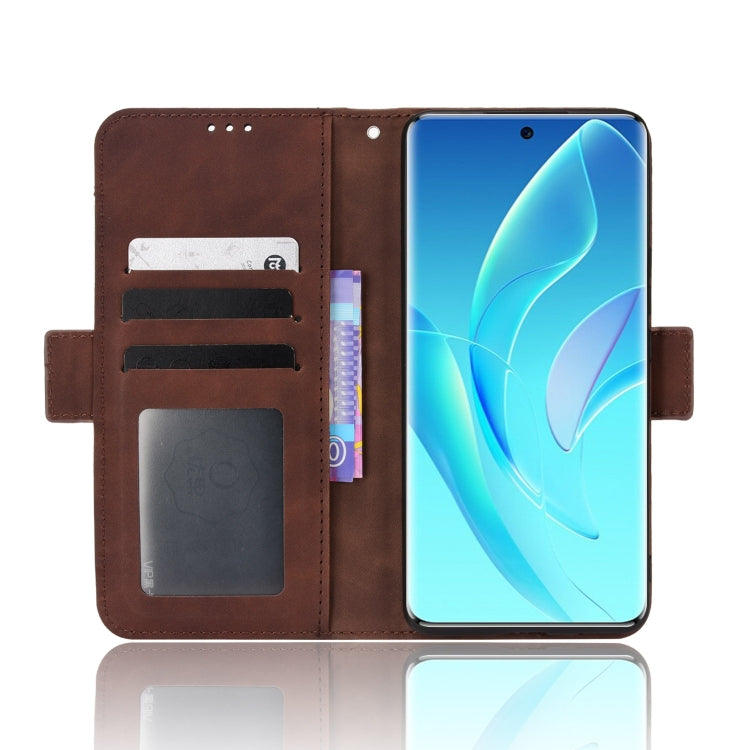 For Honor 60 Skin Feel Calf Pattern Leather Phone Case
