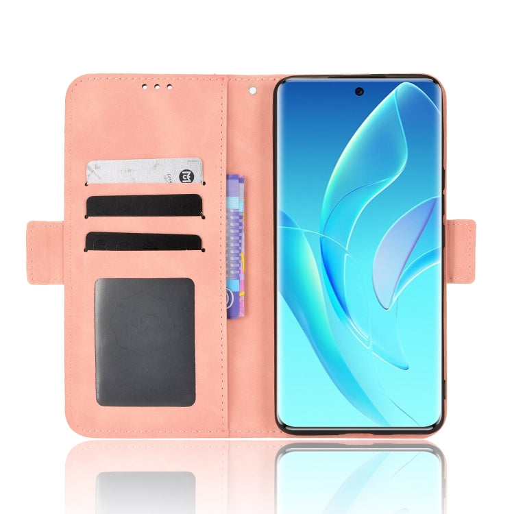 For Honor 60 Skin Feel Calf Pattern Leather Phone Case