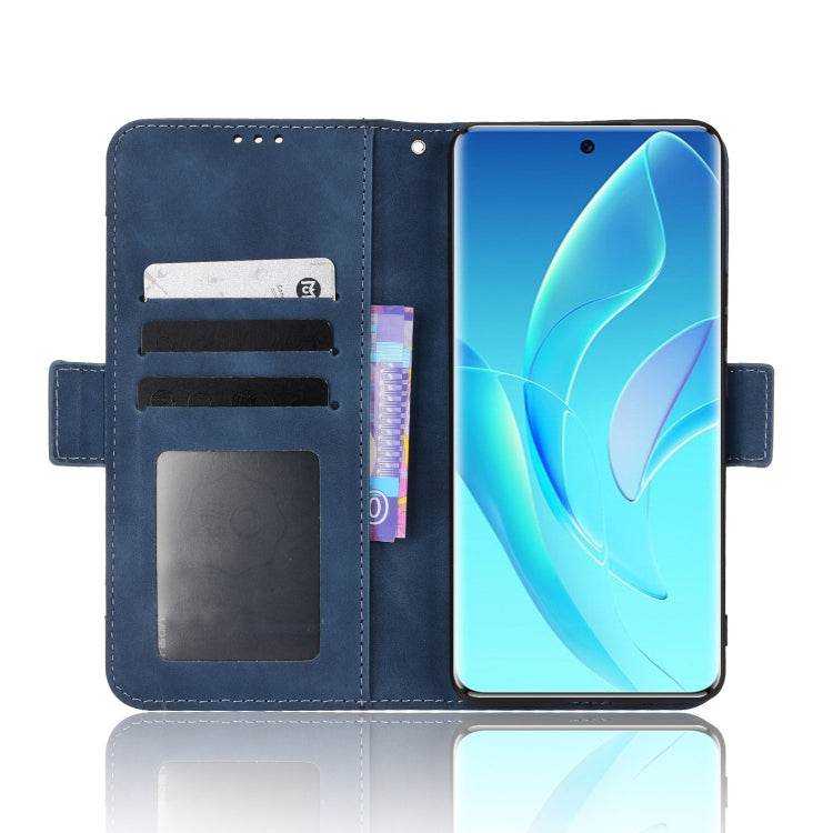 For Honor 60 Skin Feel Calf Pattern Leather Phone Case