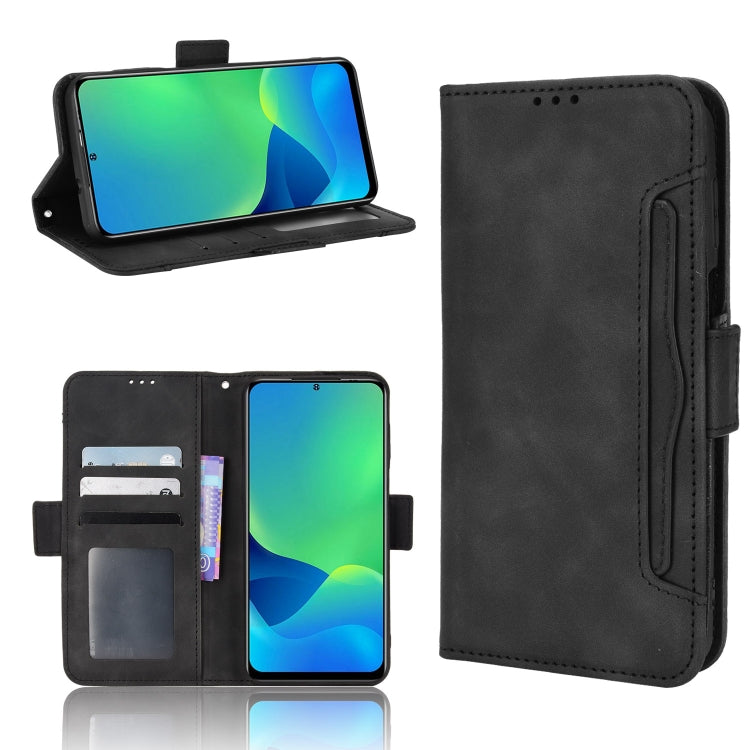 For Ulefone Note 13P Skin Feel Calf Pattern Leather Phone Case