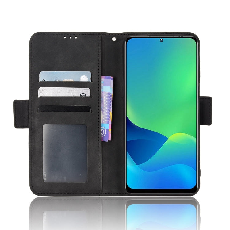 For Ulefone Note 13P Skin Feel Calf Pattern Leather Phone Case