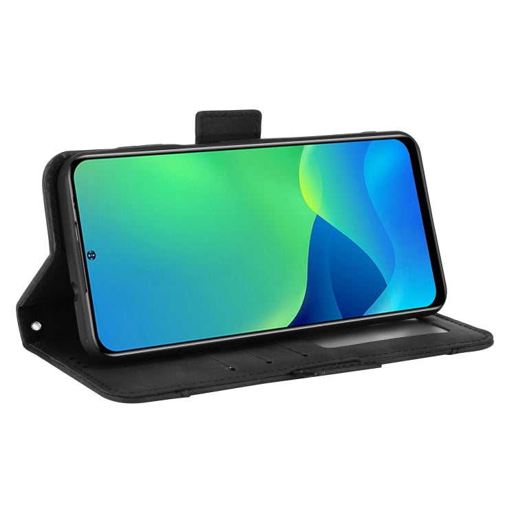 For Ulefone Note 13P Skin Feel Calf Pattern Leather Phone Case