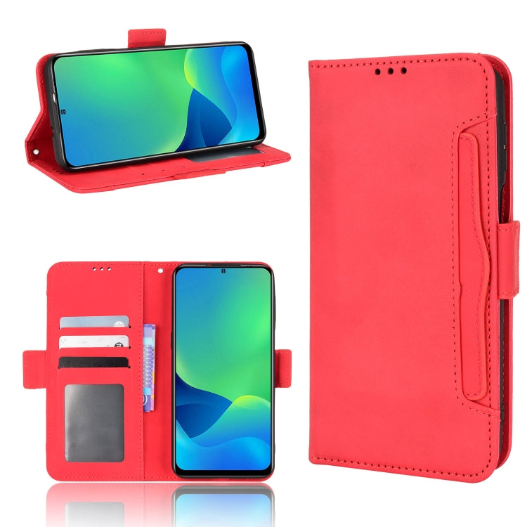 For Ulefone Note 13P Skin Feel Calf Pattern Leather Phone Case