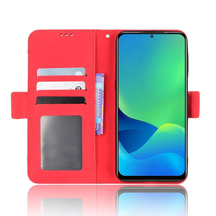 For Ulefone Note 13P Skin Feel Calf Pattern Leather Phone Case
