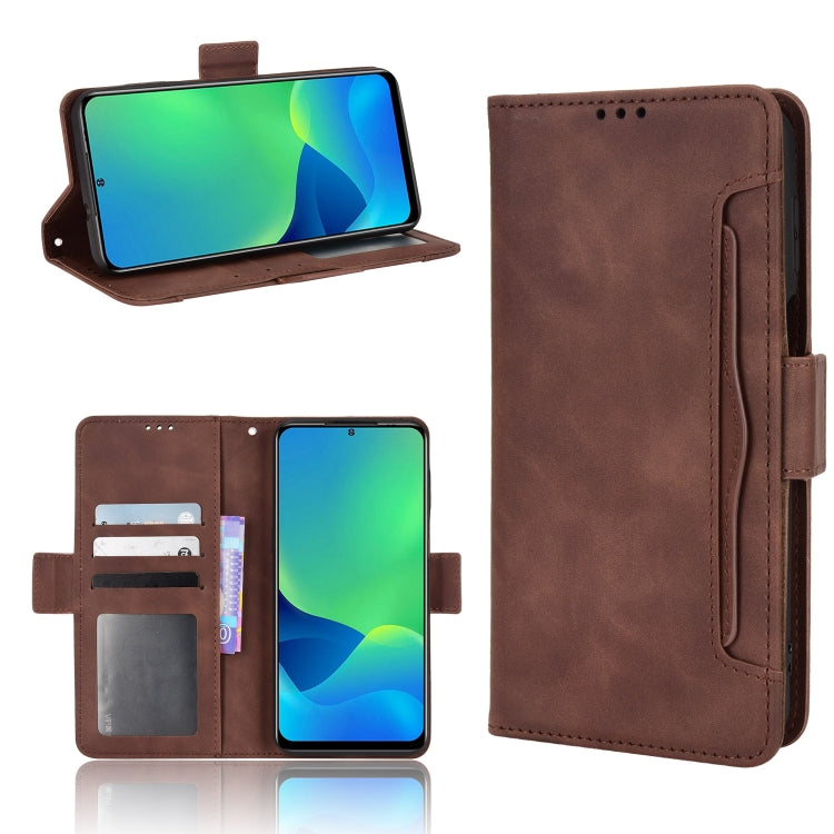 For Ulefone Note 13P Skin Feel Calf Pattern Leather Phone Case