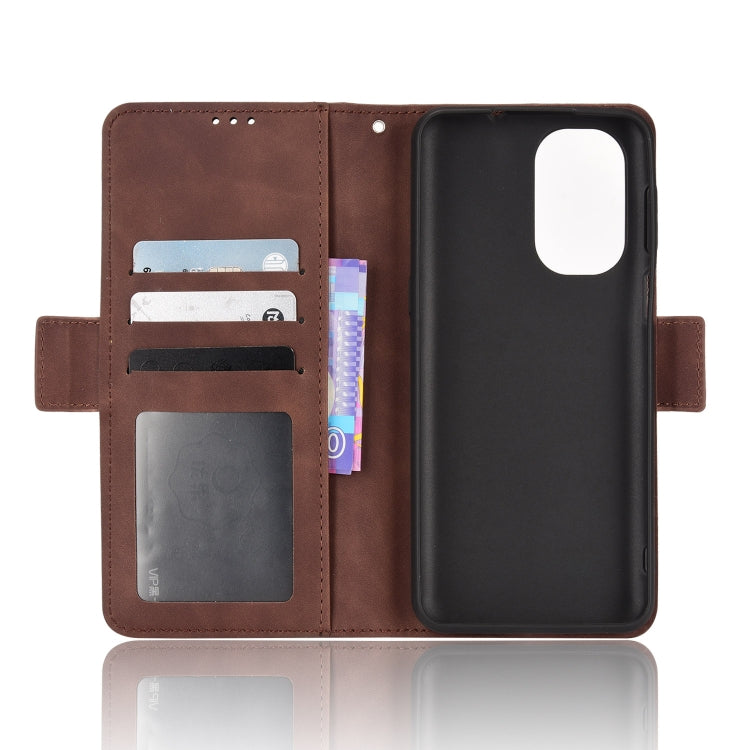 For Ulefone Note 13P Skin Feel Calf Pattern Leather Phone Case