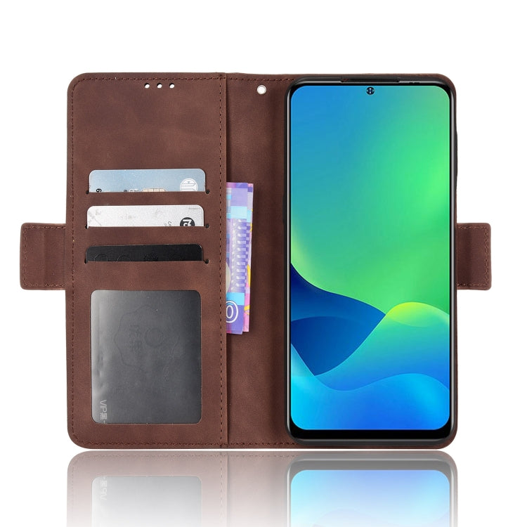 For Ulefone Note 13P Skin Feel Calf Pattern Leather Phone Case