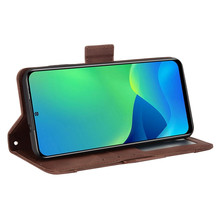 For Ulefone Note 13P Skin Feel Calf Pattern Leather Phone Case