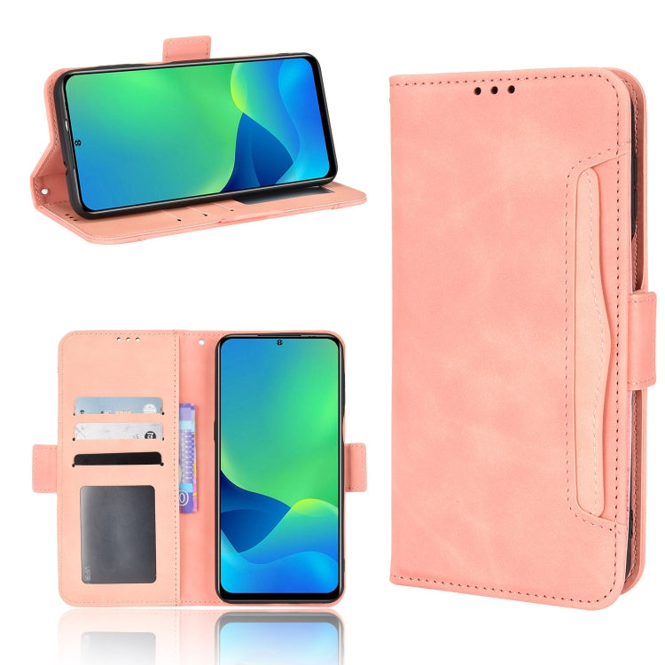 For Ulefone Note 13P Skin Feel Calf Pattern Leather Phone Case