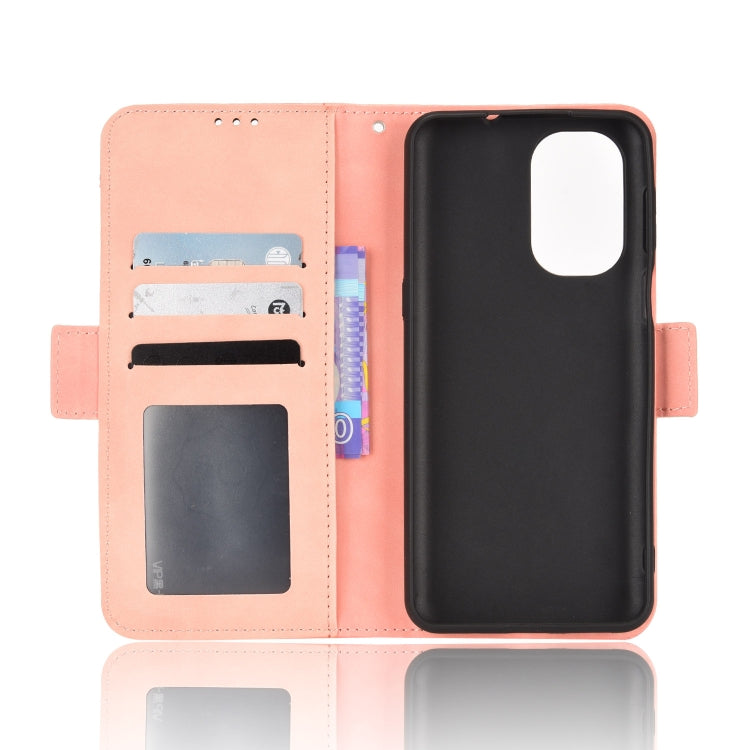 For Ulefone Note 13P Skin Feel Calf Pattern Leather Phone Case