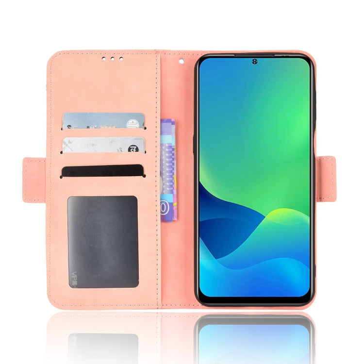 For Ulefone Note 13P Skin Feel Calf Pattern Leather Phone Case