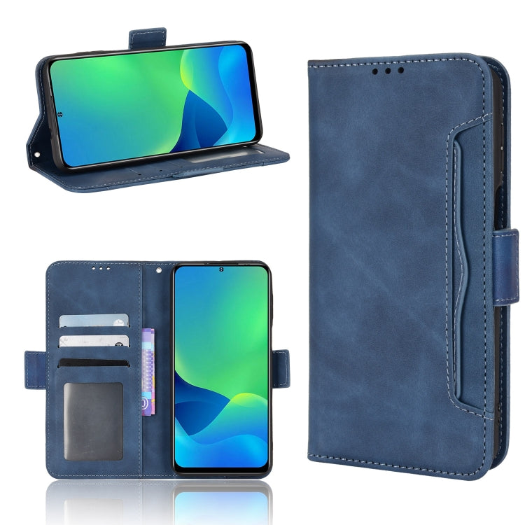 For Ulefone Note 13P Skin Feel Calf Pattern Leather Phone Case