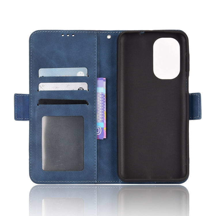 For Ulefone Note 13P Skin Feel Calf Pattern Leather Phone Case