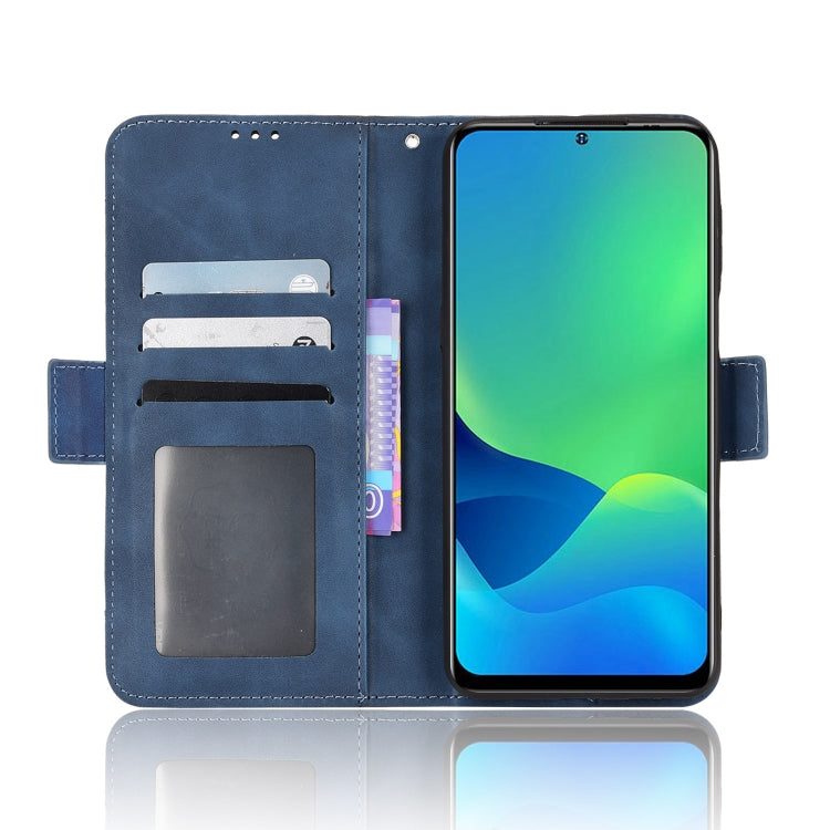 For Ulefone Note 13P Skin Feel Calf Pattern Leather Phone Case