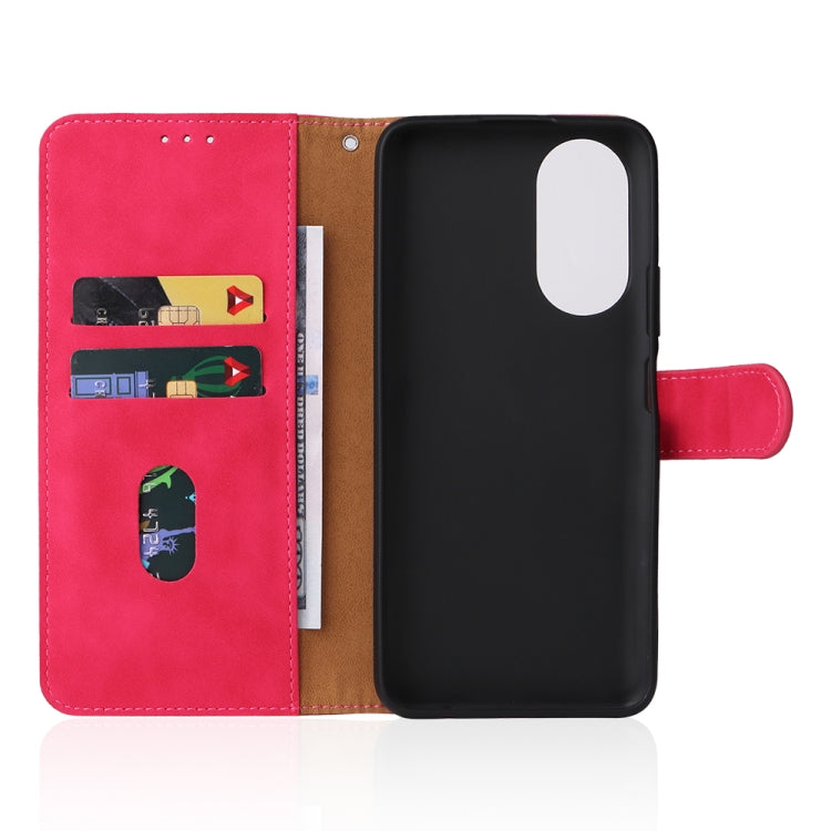 For Honor X7 Skin Feel Magnetic Buckle Calf Texture PU Phone Case