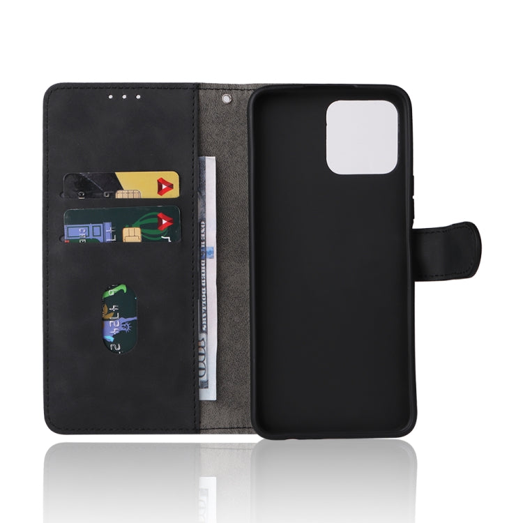 For Honor X8 Skin Feel Magnetic Buckle Calf Texture PU Phone Case