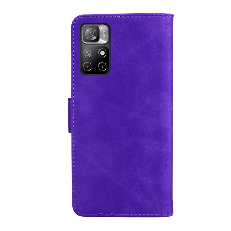 For Xiaomi Redmi Note 11 Skin Feel Pure Color Flip Leather Phone Case