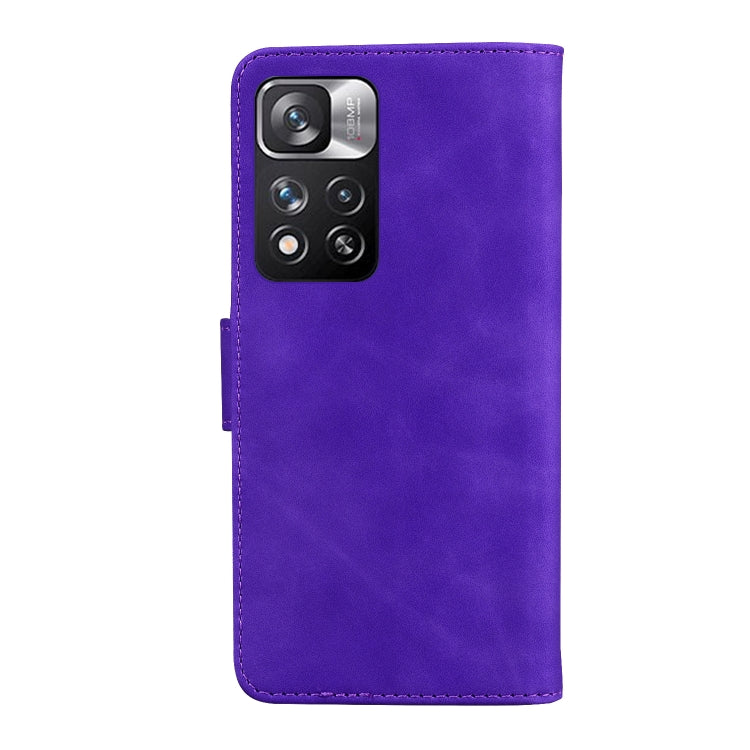 For Xiaomi Redmi Note 11 Pro / Note 11 Pro+ 5G Skin Feel Pure Color Flip Leather Phone Case