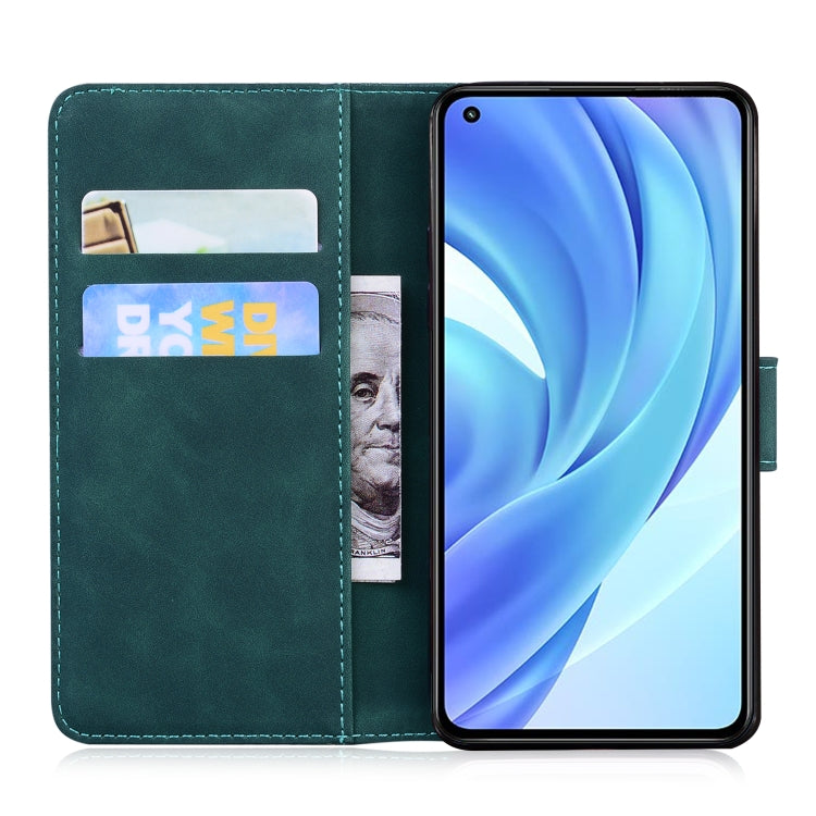 For Xiaomi Mi 11 Lite Skin Feel Pure Color Flip Leather Phone Case