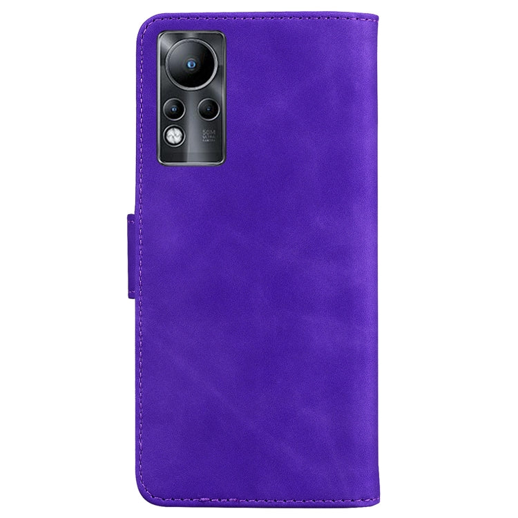 For Infinix Note 11 Skin Feel Pure Color Flip Leather Phone Case