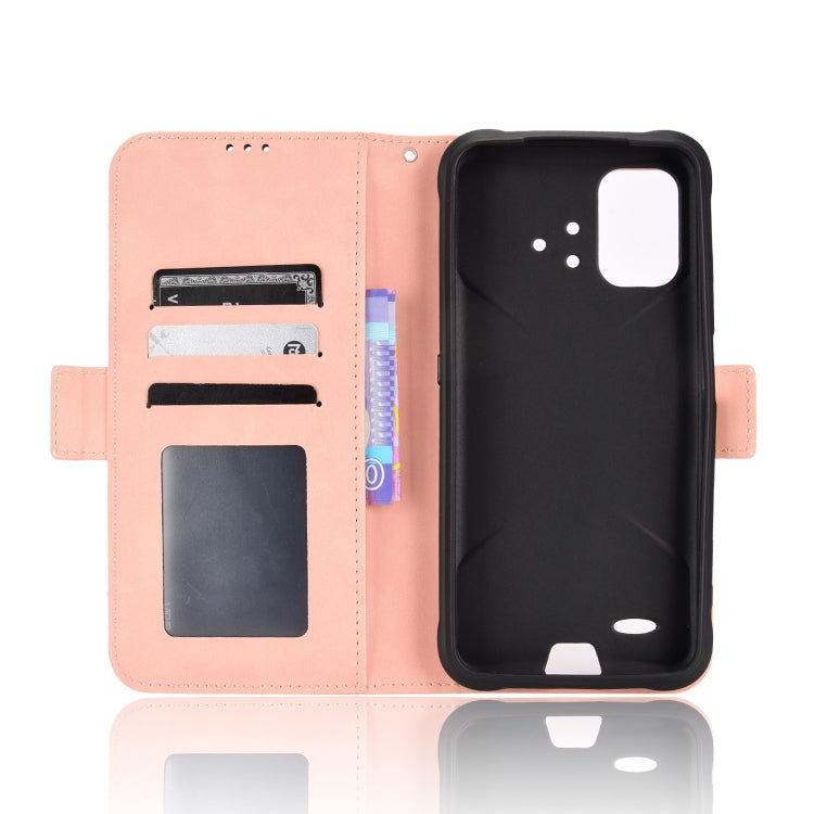 For Umidigi Bison GT2 5G / GT2 Pro 5G Skin Feel Calf Pattern Leather Phone Case