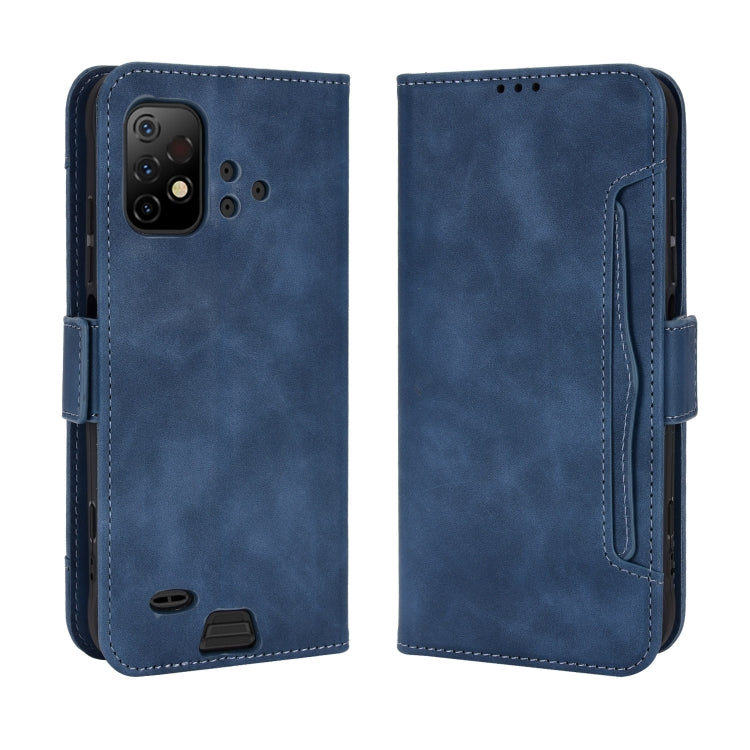 For Umidigi Bison GT2 5G / GT2 Pro 5G Skin Feel Calf Pattern Leather Phone Case