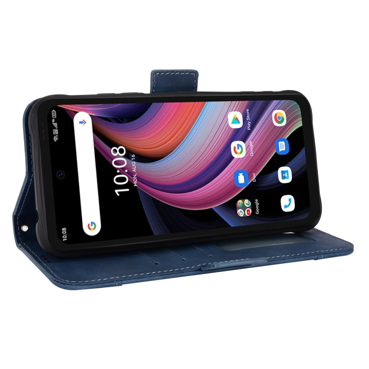 For Umidigi Bison GT2 5G / GT2 Pro 5G Skin Feel Calf Pattern Leather Phone Case