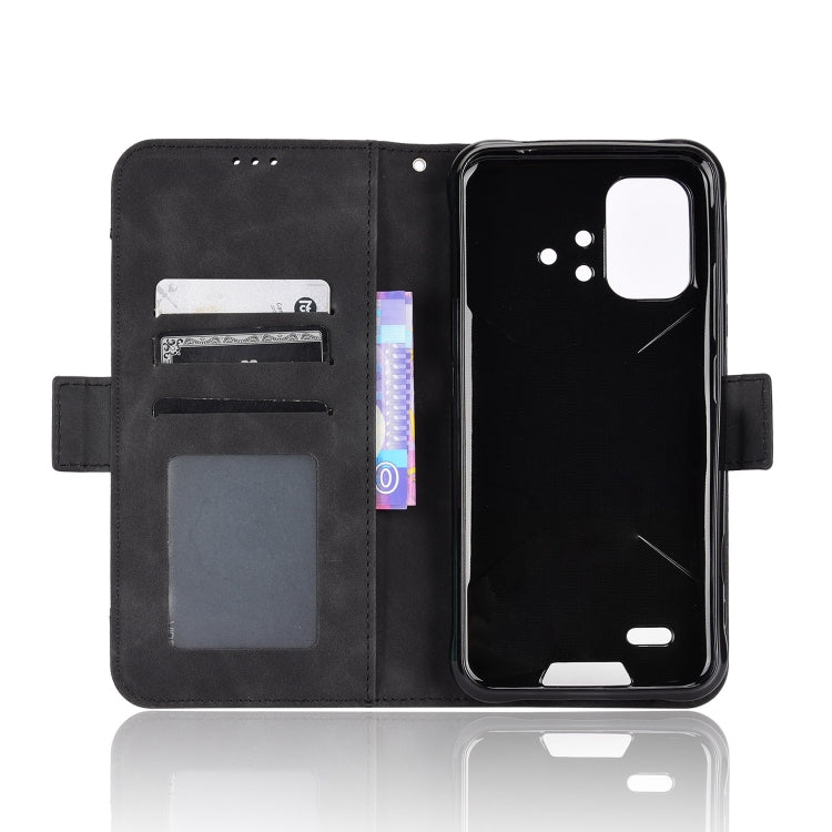 For Umidigi Bison X10G / X10G NFC Skin Feel Calf Pattern Leather Phone Case